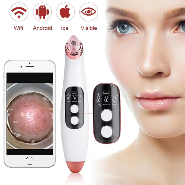 Camera Blackhead Vacuum™